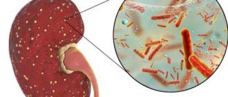 Хронический пиелонефрит у женщин симптомы и лечение