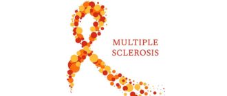 Рассеянный склероз симптомы у женщин на ранних стадиях