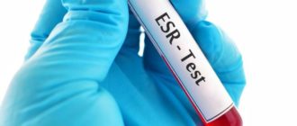 Тест на СОЭ