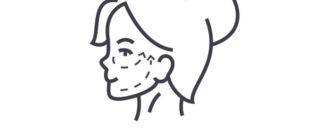 Фейслифтинг после 50 лет