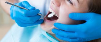Почему возникает кариес и как его лечить?
