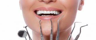 Налет на зубах