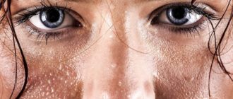 Потоотделение