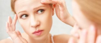 Прыщи на лбу